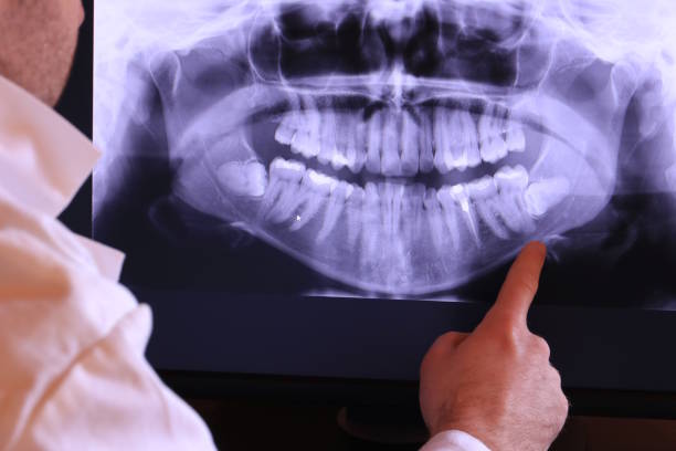Best Pediatric Emergency Dentist in Brices Creek, NC