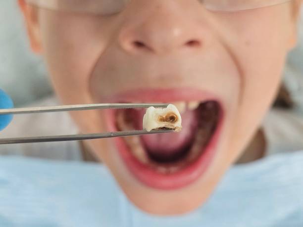 Best Same-Day Emergency Dental Services in Brices Creek, NC