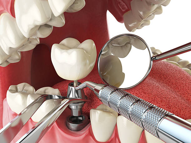 Best Emergency Denture Repair in Brices Creek, NC